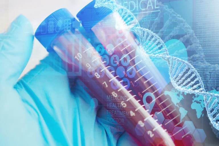 GPT-4 & RAG technology